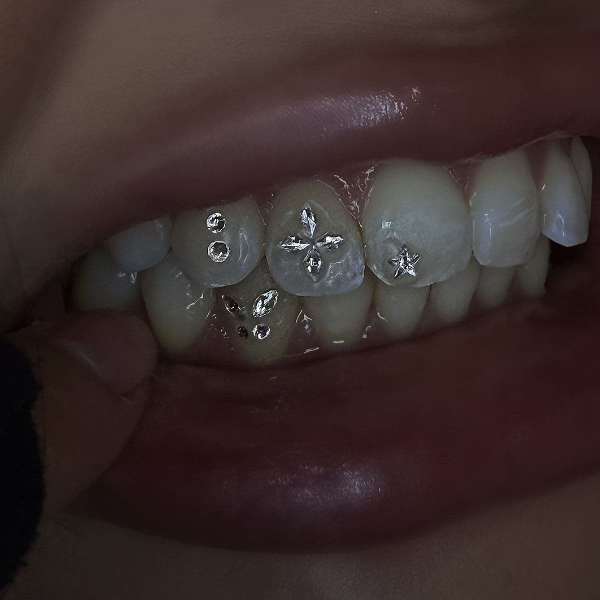The Cluster — Mixed cuts · upper smile tooth gem set